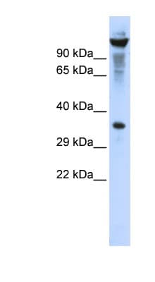 RNASET2 Antibody (aa107-156)