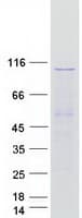 Human SEC63 Protein (Recombinant Myc-DDK (Flag))