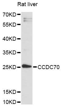 Polyclonal Rabbit anti-Human CCDC70 Antibody (WB)