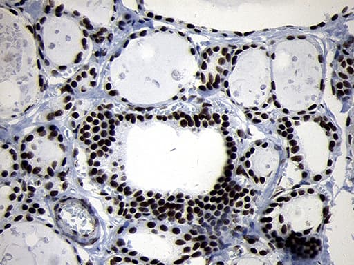 SMC1A / SMC1 Antibody (aa889-1016, clone OTI5A1)