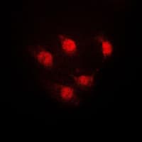 Polyclonal Rabbit anti-Human STAT5A Antibody (Internal, IF, WB)