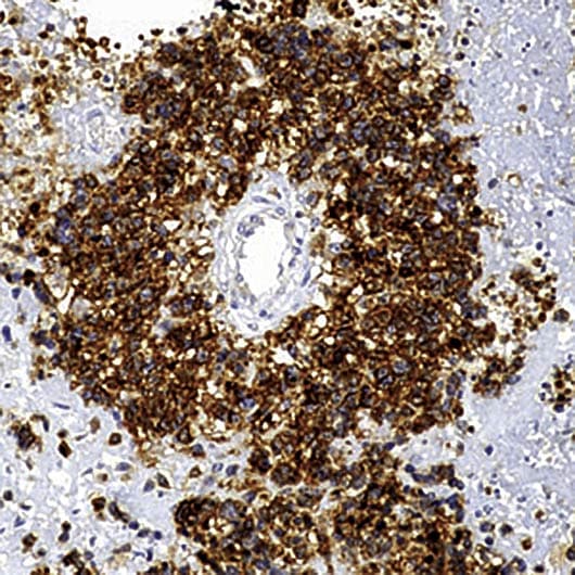 CD99 Antibody (clone HO36-1.1)