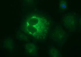 IHC-plus™ MUT / MCM Antibody (clone 2A8)