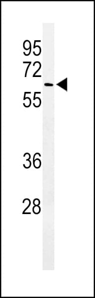 ALG10 / KCR1 Antibody (aa17-43)