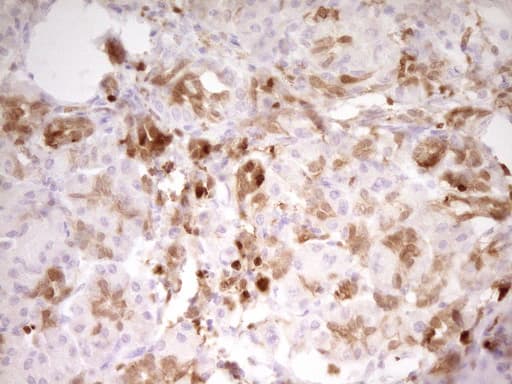 IHC-plus™ LGALS9 / Galectin 9 Antibody (clone 2A4)