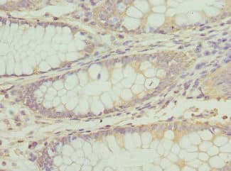 ATP2B2 / PMCA2 Antibody