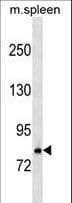 RNASEL / RNase L Antibody (aa140-167)