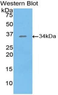 SIK2 / SNF1LK2 Antibody (aa655-925)