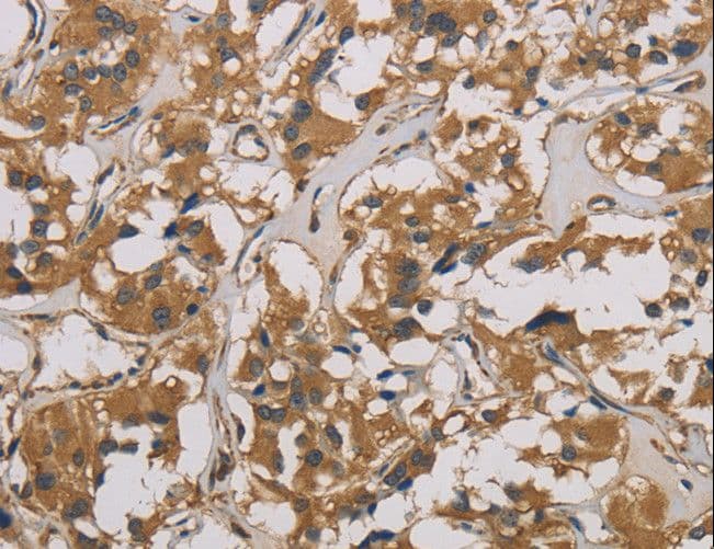 Polyclonal Rabbit anti-Human CORO1C Antibody (IHC, WB)