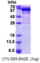 Human SCG3 / Secretogranin 3 Protein (Recombinant His)