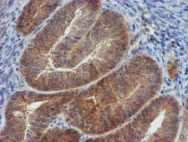 Monoclonal Mouse anti-Human Mannose Phosphate Isomerase Antibody (clone OTI4E7, IHC, WB)