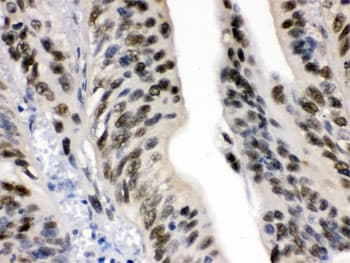 Polyclonal Rabbit anti-Human DDB1 Antibody (IHC, WB)