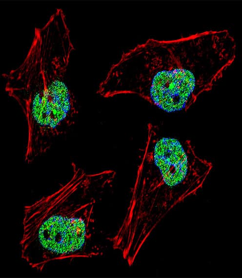NFYB Antibody (aa17-46)