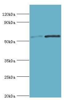 Polyclonal Rabbit anti-Human SCP2 / SCPX Antibody (aa1-322, IHC, WB)