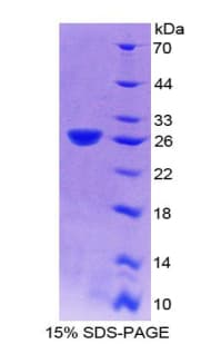 Human DNM2 / Dynamin-2 Protein (Recombinant His-T7)