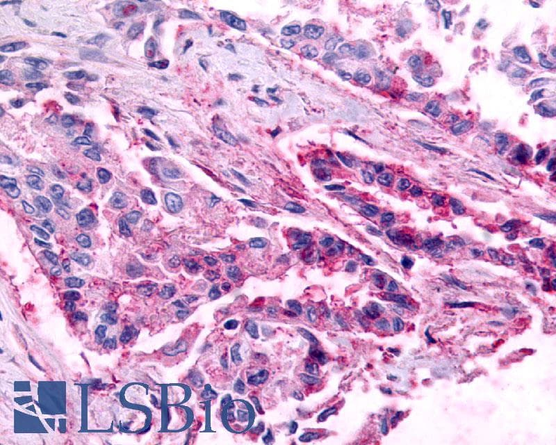 PathPlus™ CCR1 Antibody (Extracellular Domain)
