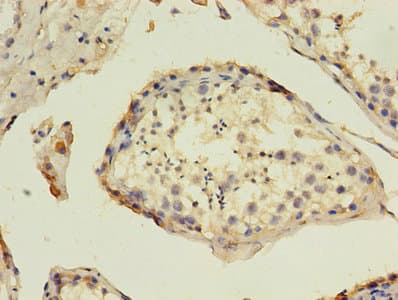 HAVCR1 / KIM-1 Antibody (aa21-290)