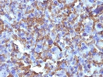Macrophage + Histiocytoma Marker Antibody (clone D11)