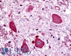 PathPlus™ GABBR1 / GABA B Receptor 1 Antibody (N-Terminus)