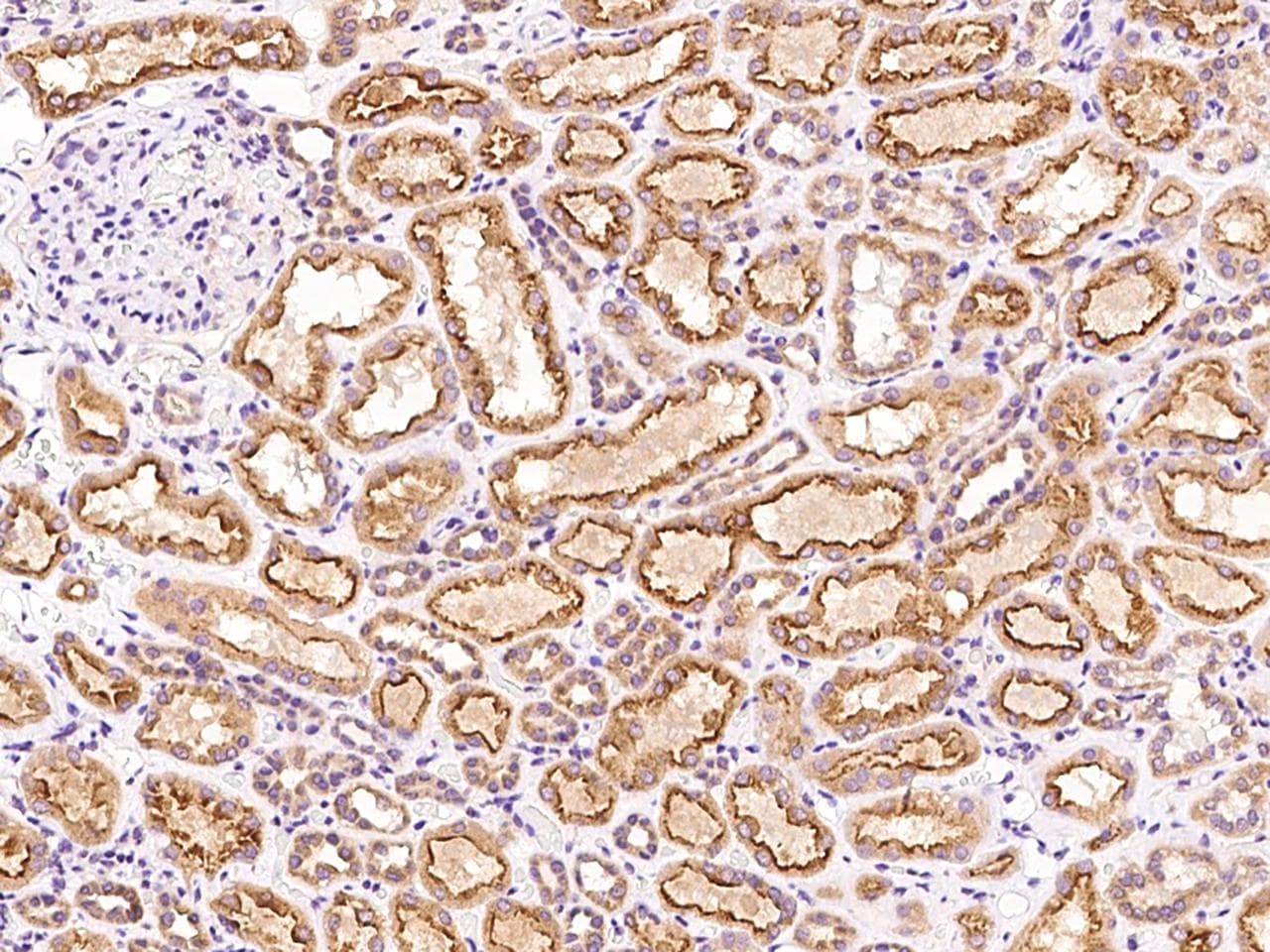 Polyclonal Rabbit anti-Human PHF13 Antibody (IHC)