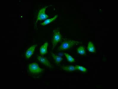 AKT2 Antibody (aa1-481)