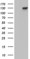 PR / Progesterone Receptor Antibody (aa1-298, clone OTI24A2)