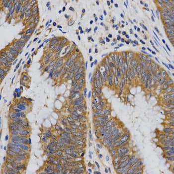 PIBF1 / PIBF Antibody