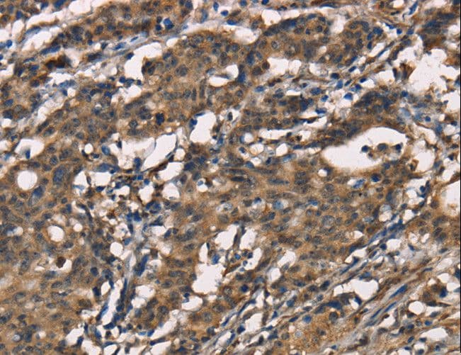 Polyclonal Rabbit anti-Human SENP1 Antibody (IHC, WB)
