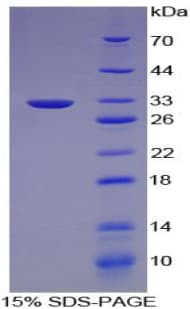 Mouse LIPG / Endothelial Lipase Protein (Recombinant 6His-T7, N-terminus)