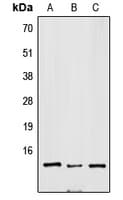 Polyclonal Rabbit anti-Human SNRPD3 Antibody (Internal, WB)