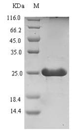 Clostridium pasteurianum Rubredoxin Protein (Recombinant 6His-SUMO, N-terminus)