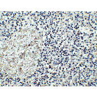 IL17RA Antibody