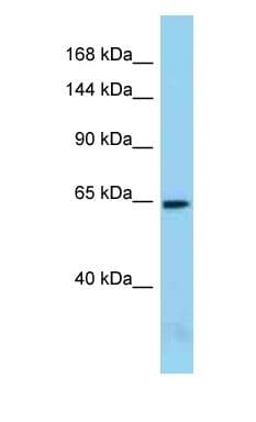 ACIN1 / Acinus Antibody (aa201-250)