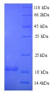 Human CD27L / CD70 Protein (Recombinant His)