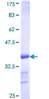 Human VPS35 Protein (Recombinant GST, N-terminus)
