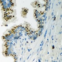 LLGL2 Antibody