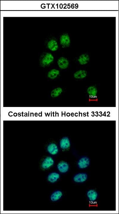 ZNF143 / STAF Antibody (aa409-621)