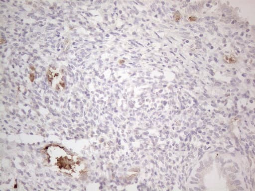 NOBOX Antibody (aa1-271, clone OTI4C5)