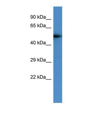Polyclonal Rabbit anti-Human FZD4 / Frizzled 4 Antibody (aa280-329, WB)