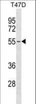 Polyclonal Rabbit anti-Human ERGIC2 Antibody (aa335-362, WB)