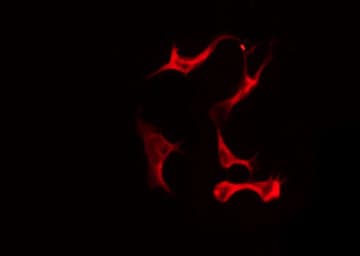 OR2M2 Antibody