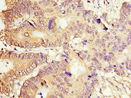 ACOT7 / BACH Antibody (aa151-380)