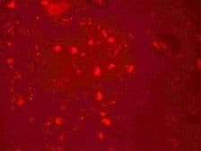 IHC-plus™ Polyclonal Chicken anti-Human ZGPAT Antibody (IHC, IF, WB)