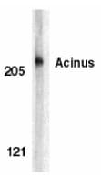 Polyclonal Rabbit anti-Human ACIN1 / Acinus Antibody (IF, WB)