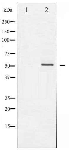 Vimentin Antibody (phospho-Ser56)