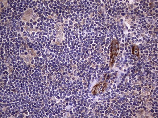 Monoclonal Mouse anti-Human VWF / Von Willebrand Factor Antibody (clone OTI2F2, aa764-1263, IHC, WB)
