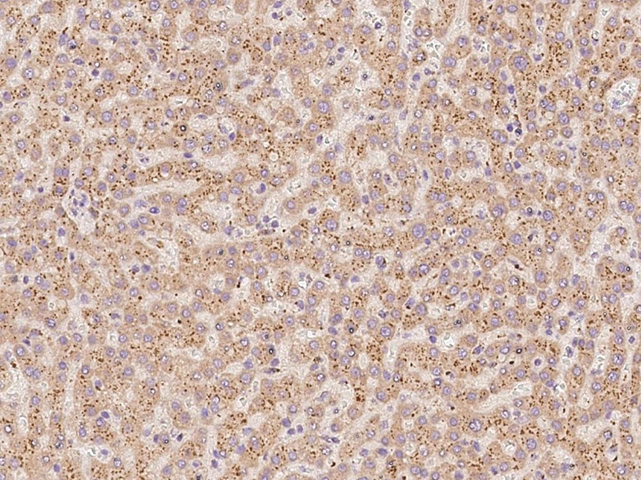 NDUFA2 Antibody