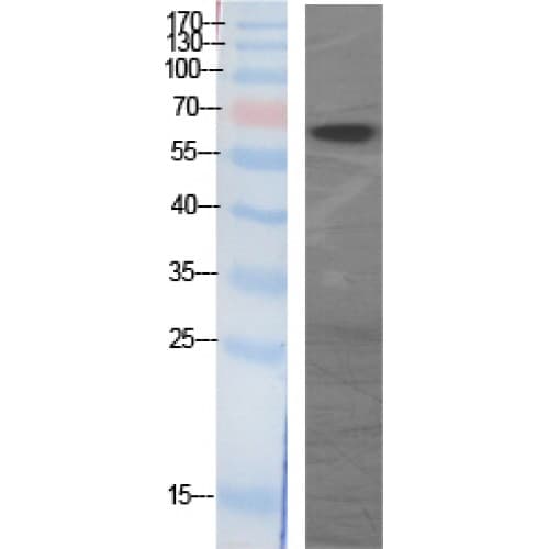 IHC-plus™ GAD 65+67 Antibody (520-600 aa, C-terminal)