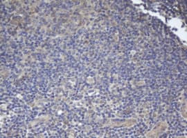 Monoclonal Mouse anti-Human BCL10 / BCL-10 Antibody (clone OTI6A8, IHC, WB)