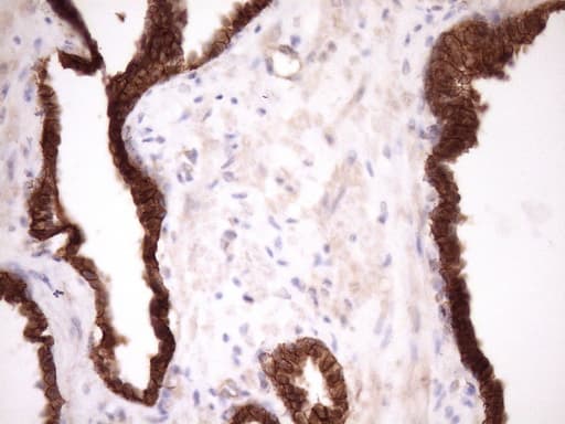 CTNNB1 / Beta Catenin Antibody (aa29-118, clone OTI2F10)
